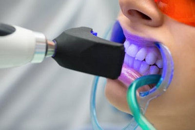 Teeth Whitening New Zealand